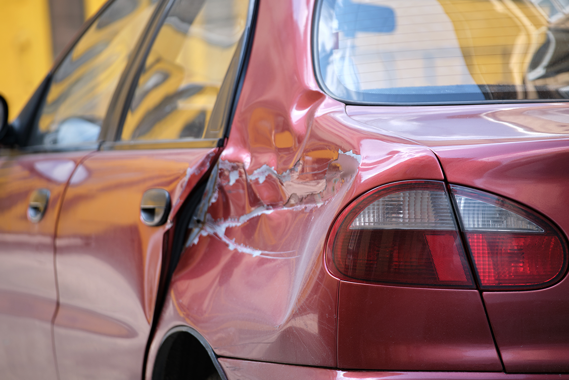 A1 Auto Body Shop Dings Dent Restoration